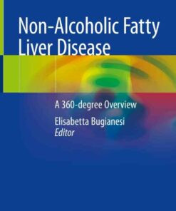 Non-Alcoholic Fatty Liver Disease: A 360-degree Overview