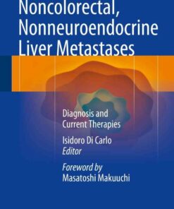 Noncolorectal Nonneuroendocrine Liver Metastases: Diagnosis and Current Therapies