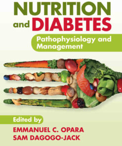 Nutrition and Diabetes: Pathophysiology and Management