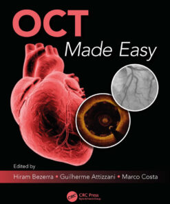 OCT Made Easy