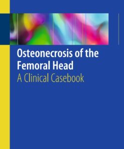Osteonecrosis of the Femoral Head: A Clinical Cas

