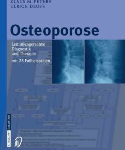 Osteoporose: Leitliniengerechte Diagnostik und Therapie mit 25 Fallbeispielen