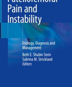 Patellofemoral Pain and Instability: Etiology Diagnosis and Management