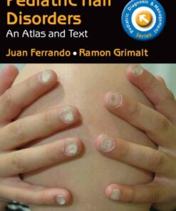 Pediatric Hair Disorders: Atlas and Text T 