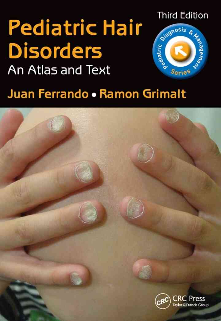 Pediatric Hair Disorders: Atlas and Text T