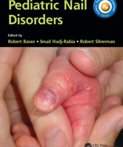Pediatric Nail Disorders