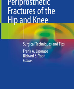 Periprosthetic Fractures of the Hip and Knee: Surgical Techniques and Tips