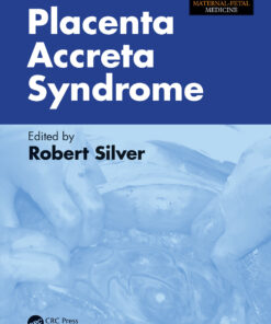 Placenta Accreta Syndrome
