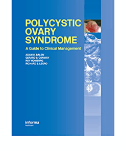 Polycystic Ovary Syndrome: A Guide to Clinical Management