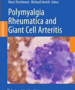 Polymyalgia Rheumatica and Giant Cell Arteritis