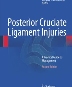 Posterior Cruciate Ligament Injuries: A Practical Guide to Management