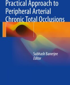 Practical Approach to Peripheral Arterial Chronic Total Occlusions