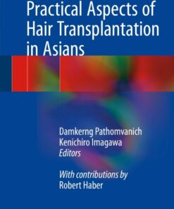 Practical Aspects of Hair Transplantation in Asians