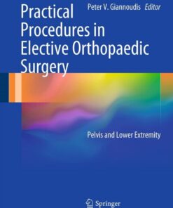 Practical Procedures in Elective Orthopaedic Surgery: Pelvis and Lower Extremity