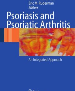 Psoriasis and Psoriatic Arthritis: An Integrated Approach