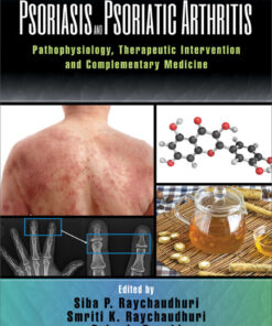 Psoriasis and Psoriatic Arthritis: Pathophysiology Therapeutic Intervention and Complementary Medicine