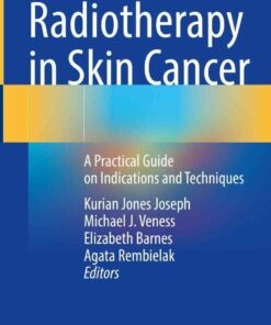 Radiotherapy in Skin Cancer: A Practical Guide on Indications and Techniques