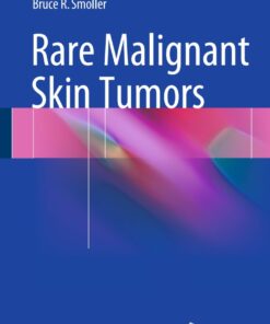 Rare Malignant Skin Tumors