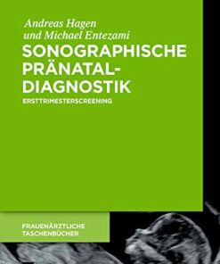 Sonographische Pr�nataldiagnostik: Ersttrimesterscreening