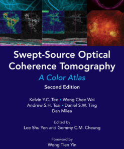 SWEPT-SOURCE OPTICAL COHERENCE TOMOGRAPHY: A COLOR ATLAS (SECOND EDITION)A Color Atlas