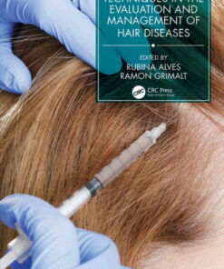 Techniques in the Evaluation and Management of Hair Diseases