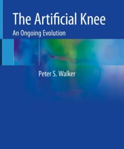 The Artificial Knee: An Ongoing Evolution
