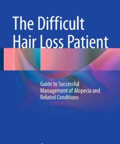 The Difficult Hair Loss Patient Guide to Successful Management of Alopecia and Rel