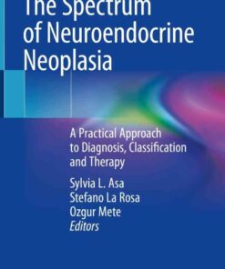 The Spectrum of Neuroendocrine Neoplasia: A Practical Approach to Diagnosis Classification and Therapy