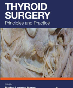 Thyroid Surgery: Principles and Practice