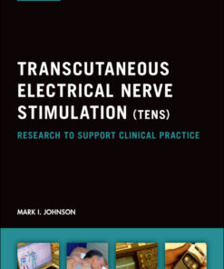 Transcutaneous Electrical Nerve Stimulation (TENS): Research to support clinical practice