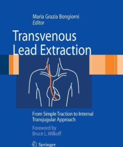 Transvenous Lead Extraction: From Simple Traction to Internal Transjugular Approach