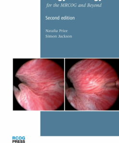 Urogynaecology for the MRCOG and Beyond