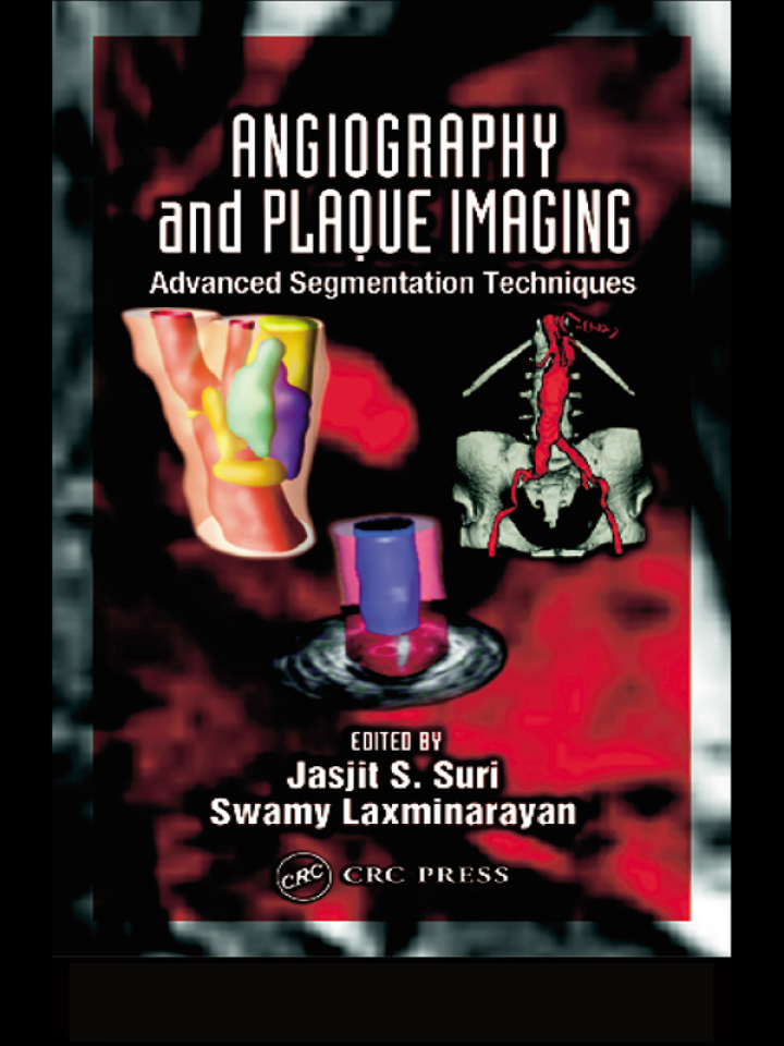 Angiography and Plaque Imaging: Advanced Segmentation Techniques