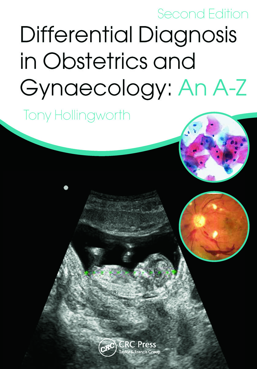 Differential Diagnosis in Obstetrics &amp; Gynaecology: An A-Z, Second Edition