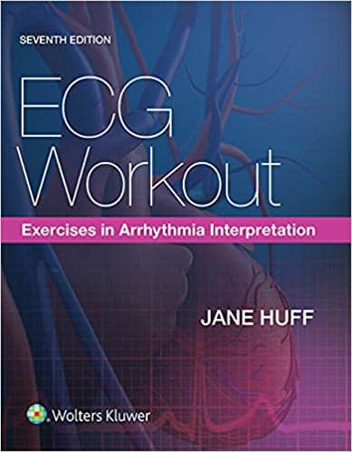 ECG Workout: Exercises in Arrhythmia Interpretation (7th Edition)