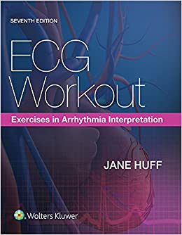 ECG Workout: Exercises in Arrhythmia Interpretation