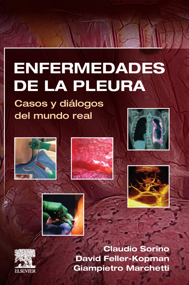 Enfermedades de la pleura: Casos y di�logos del mundo real