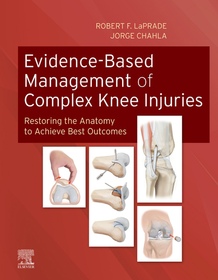 Evidence-Based Management of Complex Knee Injuries: Restoring the Anatomy to Achieve Best Outcomes