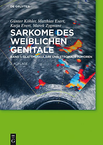 Glattmuskul�re und stromale Tumoren
