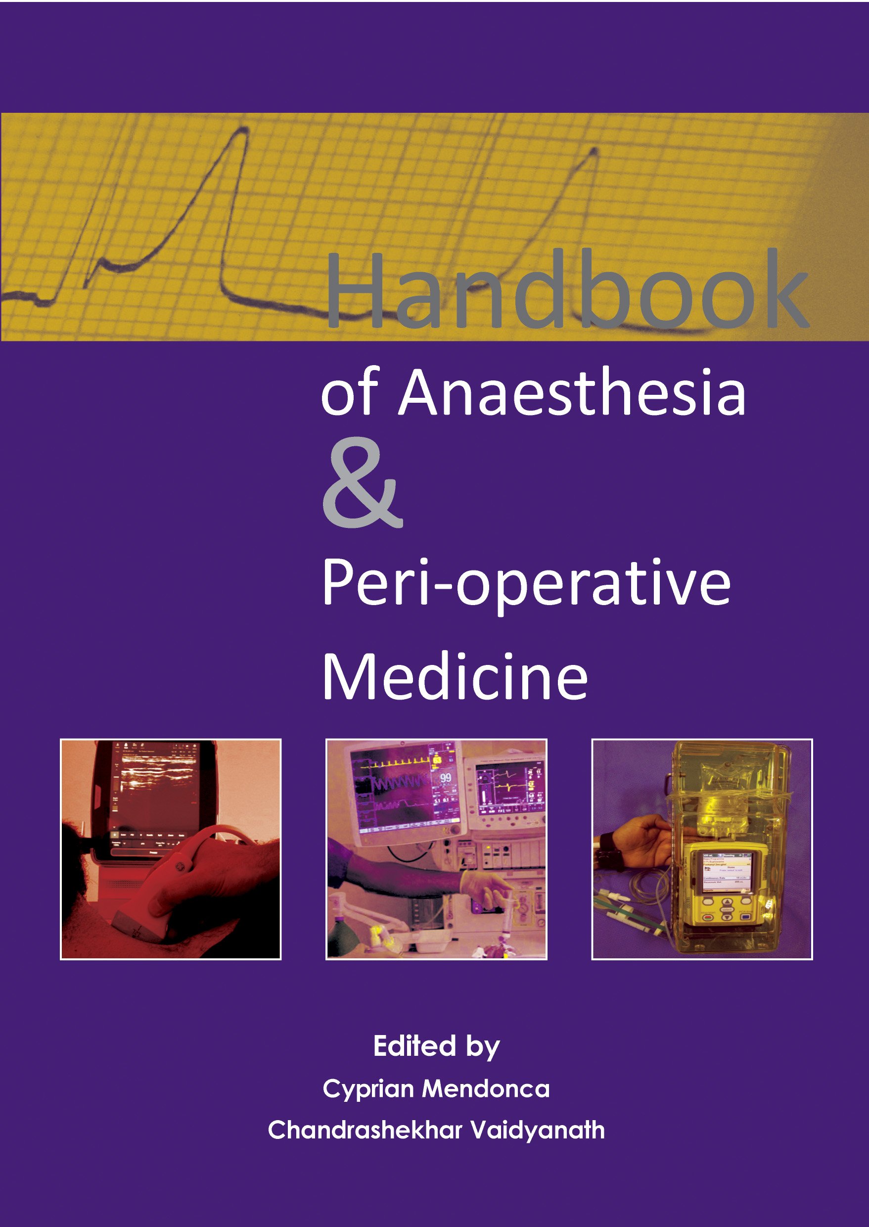 Handbook of Anaesthesia &amp; Peri-operative Medicine