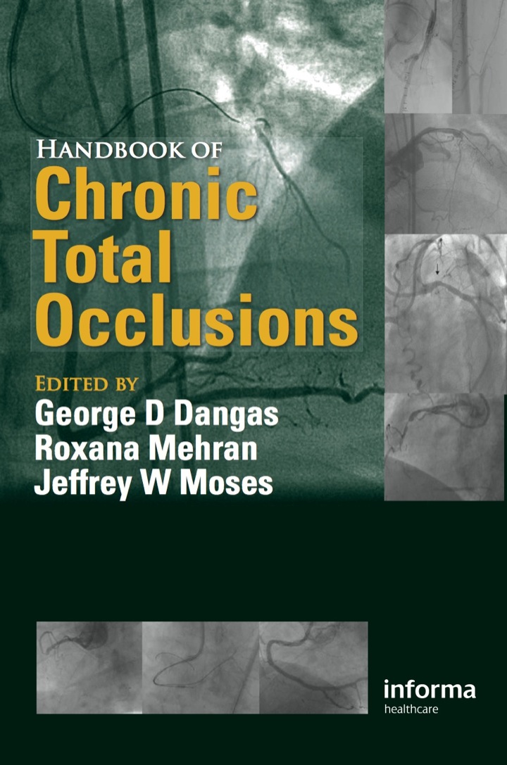Handbook of Chronic Total Occlusions