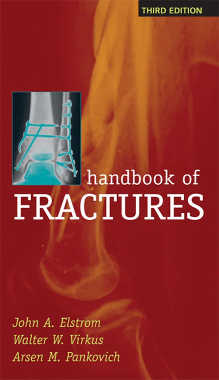 Handbook of Fractures