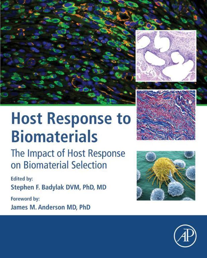 Host Response to Biomaterials: The Impact of Host Response on Biomaterial Selection