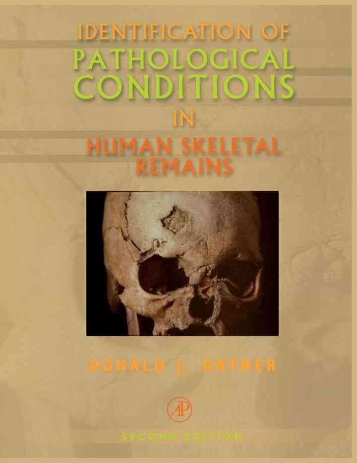 Identification of Patholog in Human Skeletal Remains