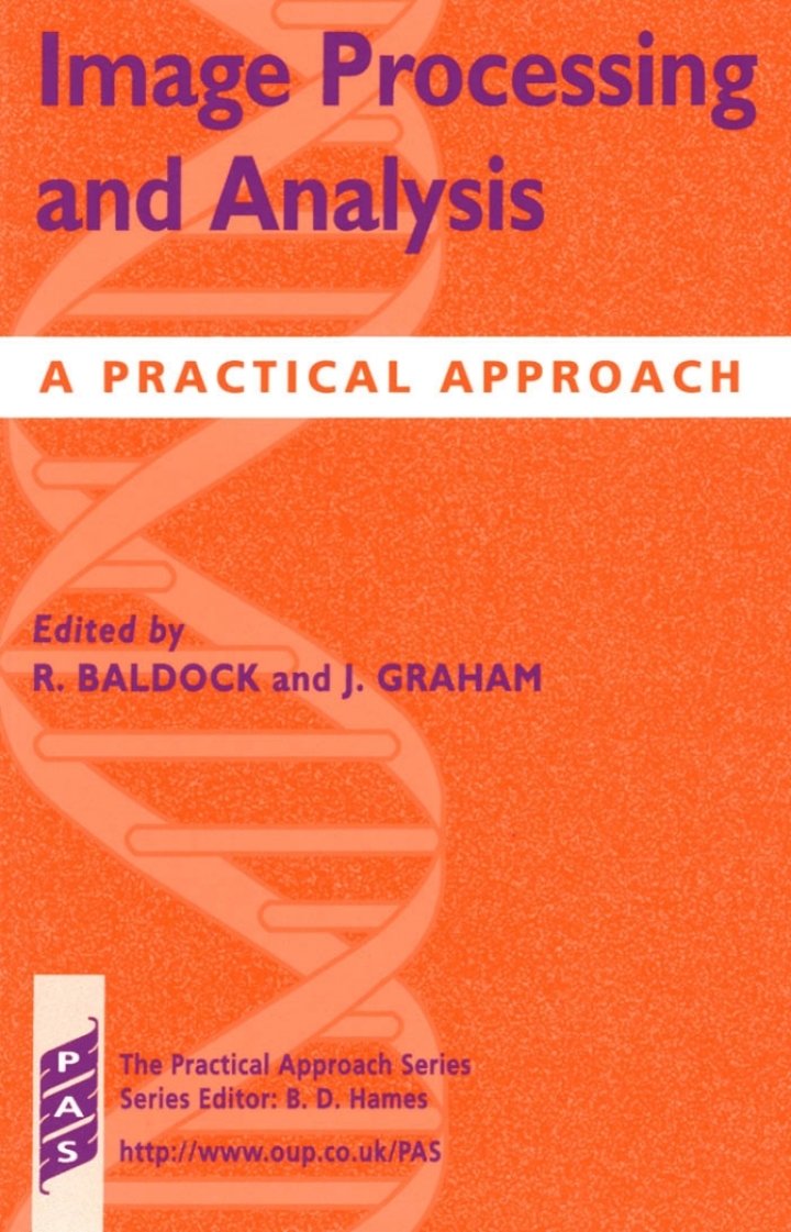 Image Processing and Analysis: A Practical Approach