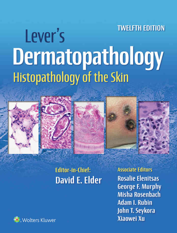 Lever's Dermatopathology Histopathology of the Skin