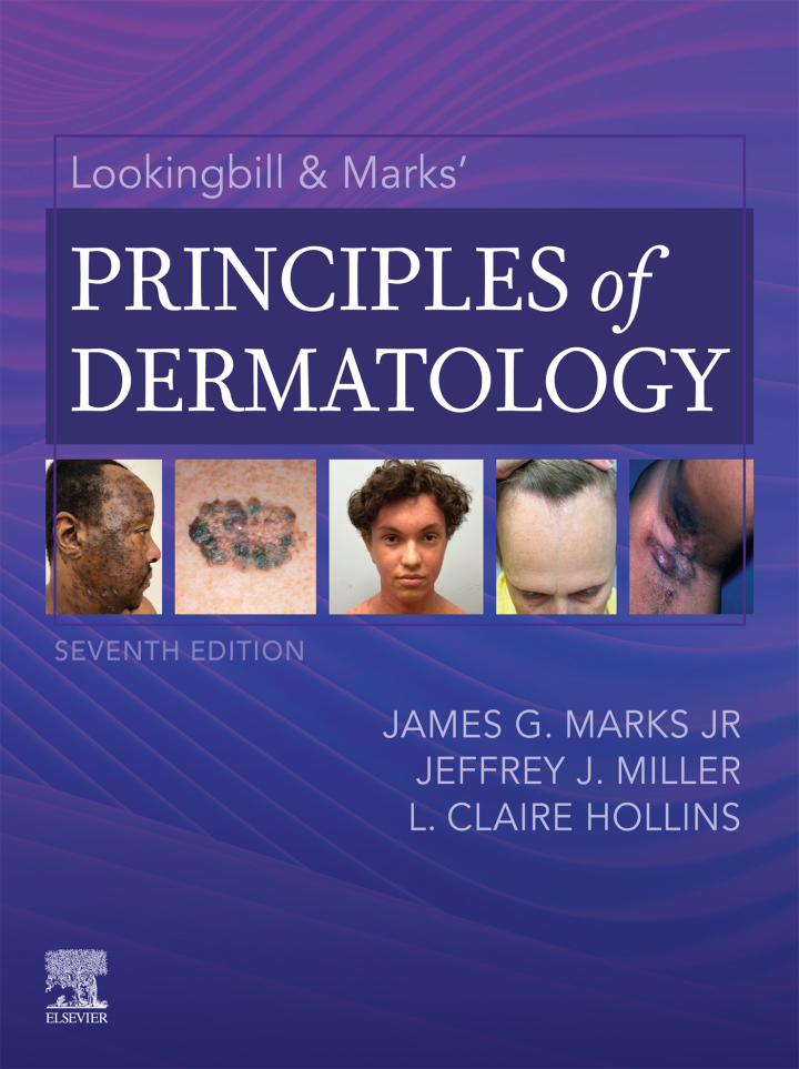 Lookingbill &amp; Marks' Principles of Dermatology