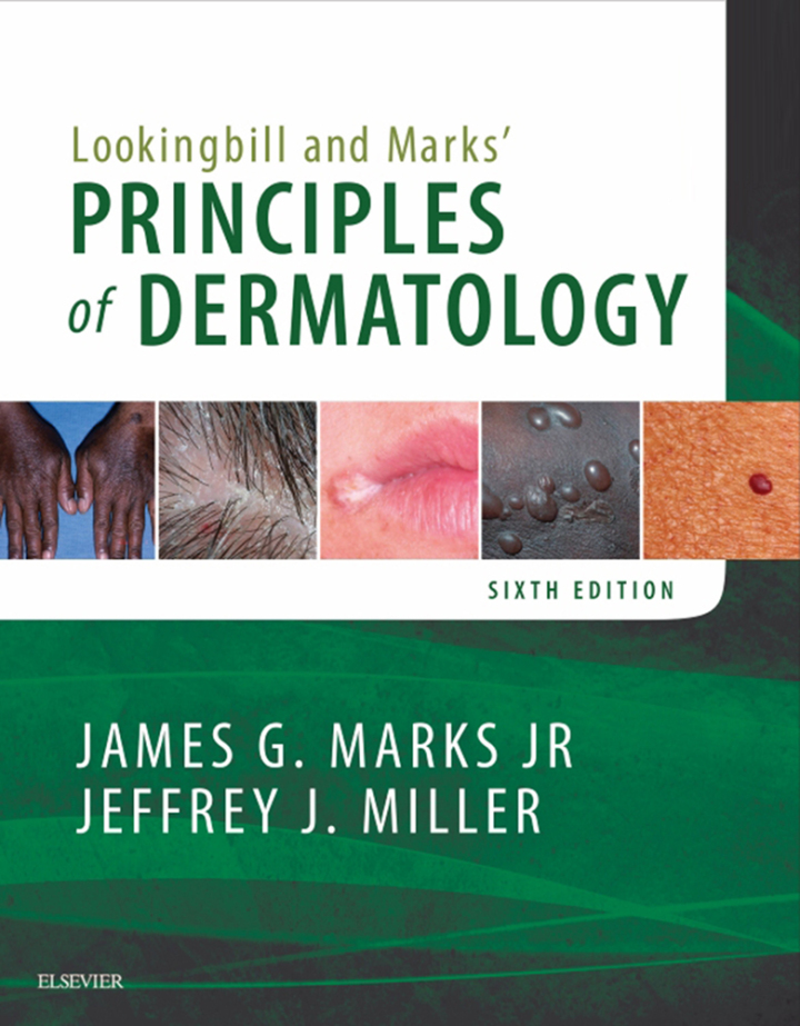 Lookingbill and Marks' Principles of Dermatology