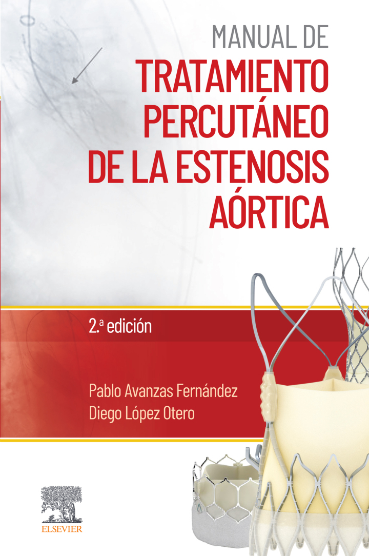 Manual de tratamiento percut�neo de la estenosis a�rtica