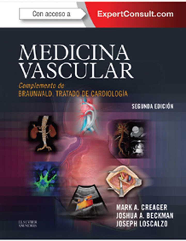 Medicina vascular: Complemento de Braunwald. Tratado de Cardiolog�a
